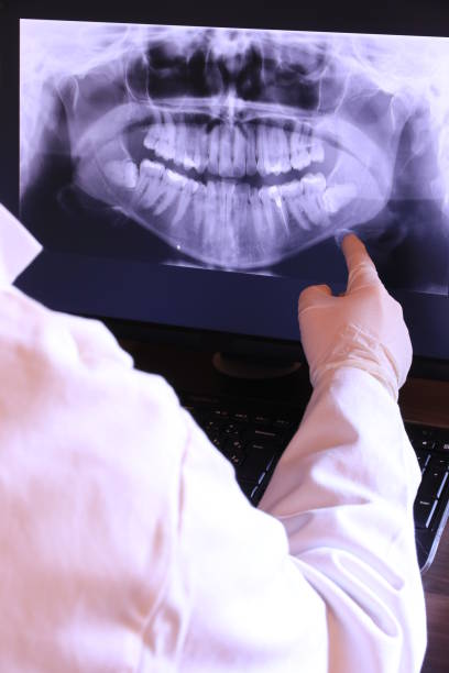 Best Emergency Dental Care for Broken or Chipped Teeth in Upper Sandusky, OH
